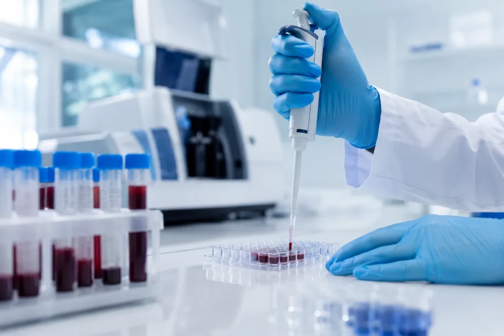 ИФА диагностика в клинике ANAMED в Намангане, лабораторное исследование крови для выявления антител, антигенов и других важных показателей | Namangandagi ANAMED klinikasida IFA diagnostikasi, antitanachalar, antigenlar va boshqa muhim ko‘rsatkichlarni aniqlash uchun qon laboratoriya tekshiruvi