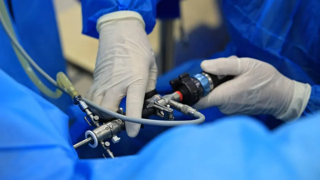 Эндоскопический инструмент для MiLEP операции в ANAMED | ANAMED klinikasida MiLEP operatsiyasi uchun endoskopik urologik asbob